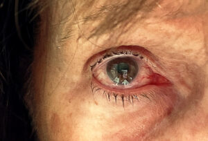 this was not caused by a Red Ryder BB gun