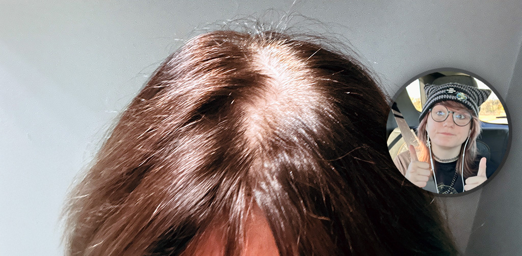 Desperate need to color roots